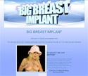 Big Breast Implant
